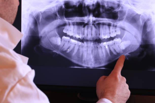 Best Emergency Dental Care for Broken or Chipped Teeth in Lake Lorraine, FL